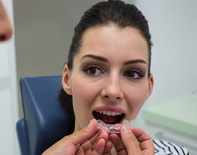 Why Choose Royal West Dentistry for Invisalign Treatment in Brampton