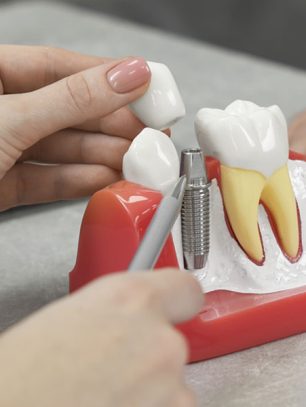 Single Tooth Implants: Procedure, Benefits, and Aftercare